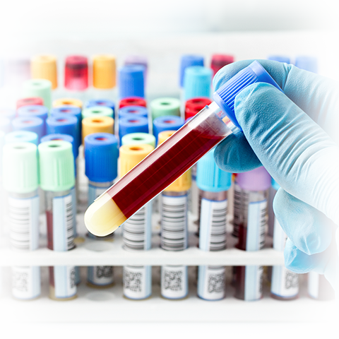 СКИДКА 20% на клинические исследования крови!